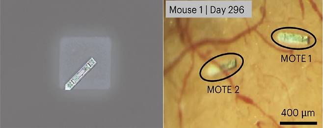 소금 결정위에 있는 MOTE 뉴럴 임플란트(좌), 실험용 쥐에 이식된지 296일 지난 후의 MOTE 뉴럴 임플란트들(우)
