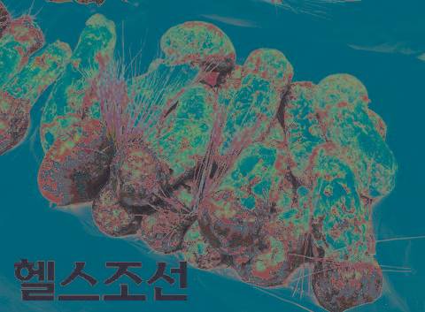 [헬스조선]송이버섯