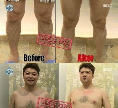 니글니글 전현무, 제모소감 "흉터와 혈관을 처음 봤다. 돌 지난 아기피부 같아"