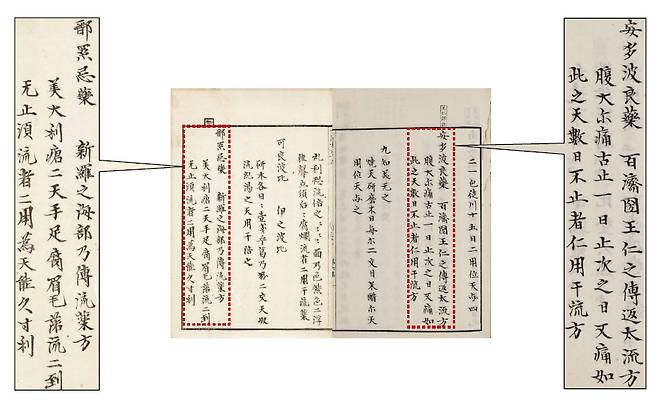 권 95의 일부분. 신라의 ‘해부’(海部)란 관청에서 전하는 약방(新羅之海部乃傳流藥方)이란 구절이 보이고, 근육을 술에 담가 끓여서 나병 치료약을 만드는 특유의 처방전을 나란히 기술했다.(왼쪽 확대한 부분) 백제 박사 왕인의 처방이 나오는  권 37의 일부분. 백제국 왕인이 전해준 처방이란 구절(百濟國王仁之傳返太流方)과 일본 가나식으로 표기한 약 이름 ‘안다파량약’(安多波良藥)이 보인다. 복통이 멈추지 않을 때 약제를 만드는 처방을 적었다.(오른쪽)  연세대 동은의학박물관 제공