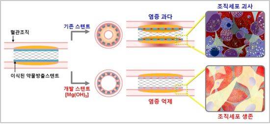 ▲심장질환에 대한 새로운 약물 스텐트가 개발됐다.[사진제공=KIST]