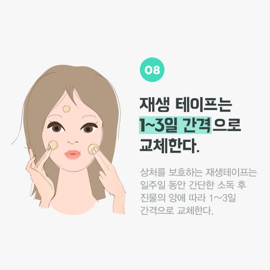 재생테이프는 1~3일 간격으로 교체한다.