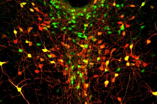 배측봉선핵(DRN) 뉴런 사진
