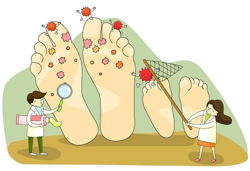무좀 환자의 발을 치료하는 의사
