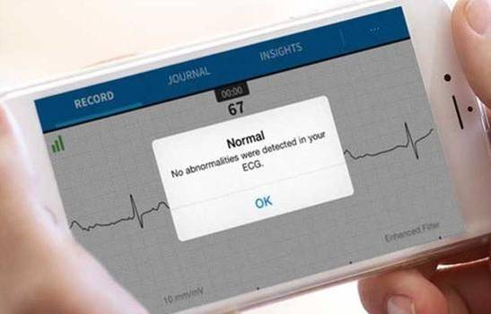 얼라이브코는 스마트폰에 부착해 심전도를 측정한다.  환자들은 자신이 측정한 심전도 데이터를 스마트폰 애플리케이션에 축적하고, 심혈관질환 전문의에게 자동으로 전송할 수 있다. 병원은 환자의 데이터를 전자의무기록(EMR)과 연동해 평소 환자의 건강 상태를 확인하고 심장 건강 상태를 확인한다.