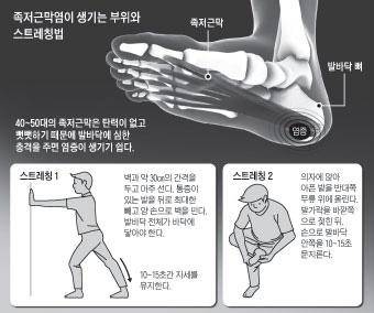 [헬스조선]족저근막염은 발바닥 전체에 통증을 유발해 보행을 어렵게 만든다. 쿠션이 충분한 신발을 신고, 틈틈히 발바닥 부위를 스트레칭 해주는 것이 족저근막염을 예방하는 방법이다/사진-조선일보 DB