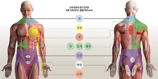 실제 질병이 생긴 곳과 전혀 다른 곳에 통증이 생겼다면 ?연관통?을 의심해 봐야 한다. 우리 몸은 몇 개의 신경이 연결돼 있어 뇌가 통증을 착각하기도 한다. 심장에 문제가 생기면 새끼손가락이, 폐 질환이 있으면 목 주위가 아플 수 있다.