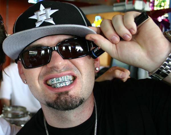 [헬스조선]최근 젊은층 사이에서 유행하는 치아 액세서리인 그릴즈는 잘못 사용하면 치아 건강을 위협할 수 있어 주의해야 한다/사진=일산사과나무치과병원 제공