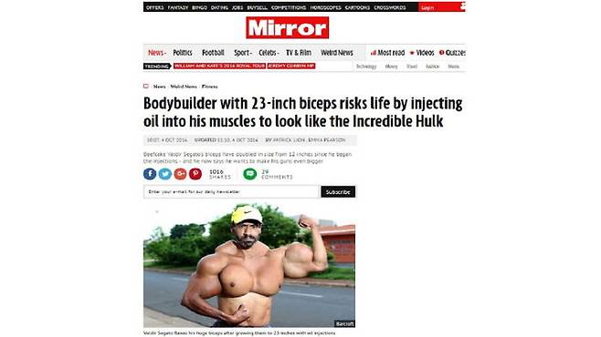 근육질 몸매 되려고 기름주사 투여한 보디빌더 남성