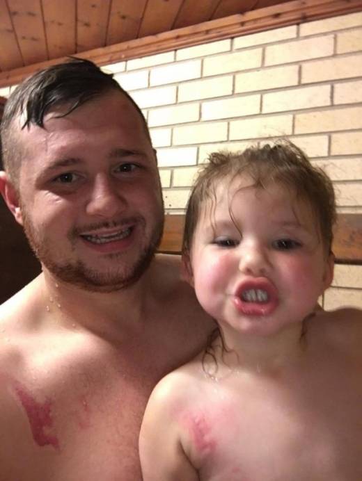 자신의 화상 흔적에 대해 지나치게 의식하던 프레야는 아빠 덕분에 밝은 모습을 되찾았다. (사진=키즈스팟)