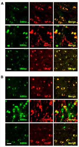 흰쥐에 주입된 사람 지방줄기세포가 신경세포로 분화한 모습-논문 발췌-.