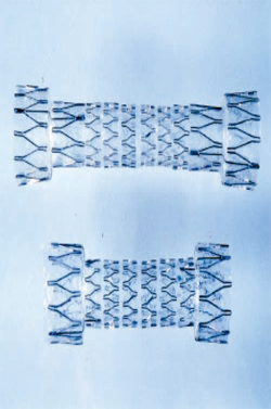 종이접기 기술을 활용해 개발한 스텐트는 수술의 안정성을 높였다.