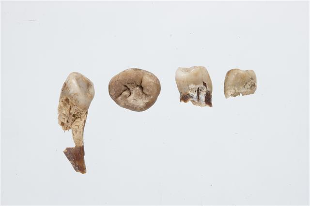 대왕묘에서는 출토된 성인 여성의 것으로 드러난 치아 4쪽. 사진 국립전주박물관 제공