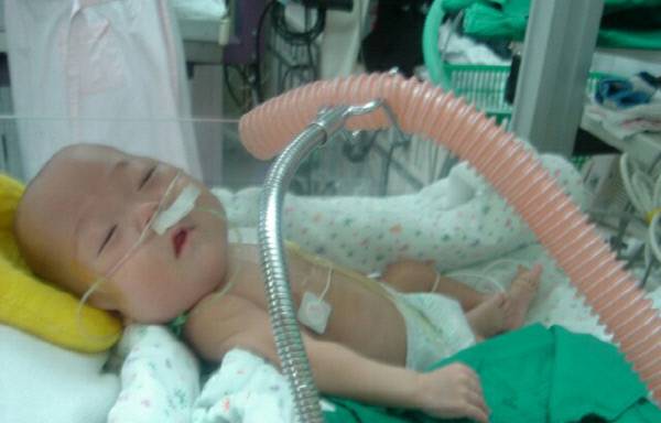 - Wu-gyeong, who weighed less than a kilogram at birth in May 2004, is inhaling the vapors from a humidifier, in which sterilizers have been added, in the intensive care unit shortly after her birth. At the time, the nurse attached a thick hose to the humidifier, and fixed it so that the vapors would come out right in front of her nose.