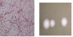 (왼쪽)0.05% basic fuchsin으로 염색한 레지오넬라균 (1,000배) (오른쪽)해부현미경으로 관찰한 레지오넬라균 집락사진(100배)