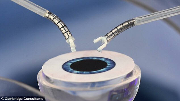 캠브리지 컨설턴트가 개발한 안과 수술 로봇 `액시스(Axsis)`