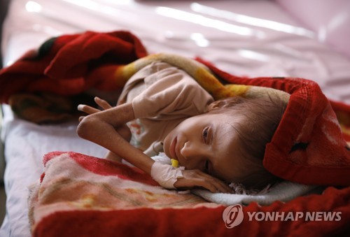 지난해 1월 예멘의 수도 사나의 한 병원에서 어린이가 침대에 누워 치료를 기다리고 있다. [AP=연합뉴스 자료사진]