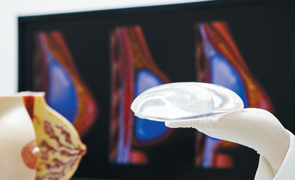유방 재건술이나 성형술에 쓰이는 실리콘 보형물이 유방 림프암의 발병 위험을 높이는 것으로 알려져 각별한 주의가 필요하다. / 신지호 헬스조선 기자