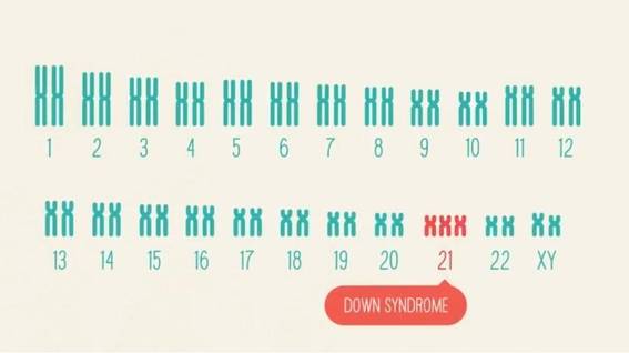 카운실의 유전자 검사 서비스를 통해 미래 자녀의 다운증후군 가능성 등 100여개의 유전질환 발생 위험도를 예측할 수 있다. / counsyl 홈페이지 제공