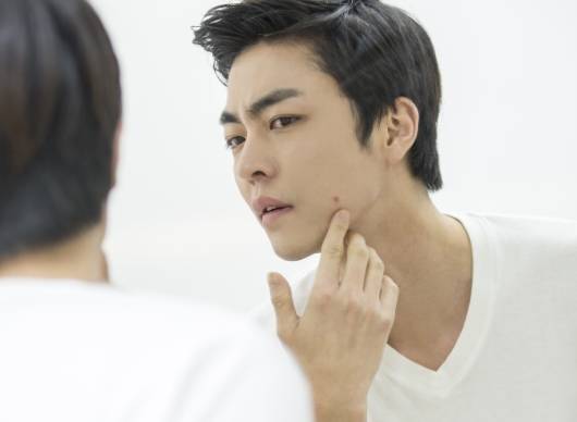 턱 여드름을 확인하는 남자