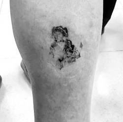 ‘한일관’ 대표 김모(여·53)씨가 지난달 30일 최시원(30)씨 가족의 반려견에게 물리자 서울백병원 응급실을 찾아 상처 부위 사진을 찍은 모습. 왼쪽 다리 종아리에 이빨 자국이 2~3㎝로 나 있다. /서울백병원 의사