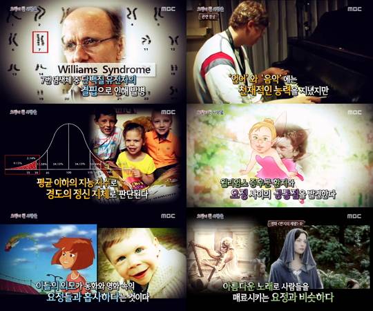 신비한 TV 서프라이즈, 윌리엄스 증후군 소개 (사진=방송캡처)