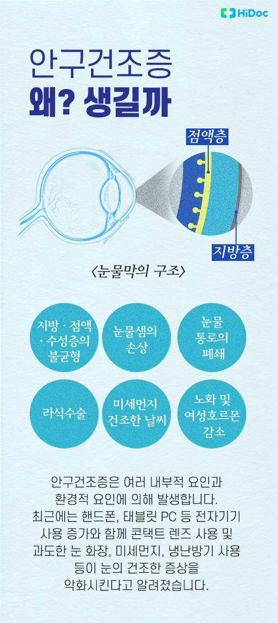안구건조증