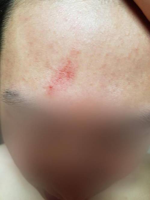 폭행당한 피해자[피해자측 제공=연합뉴스]