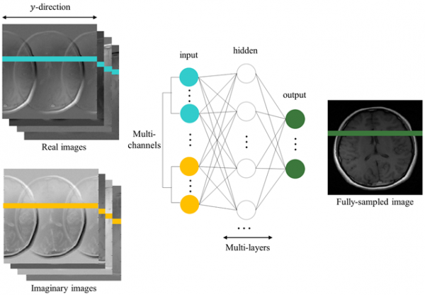KAIST 연구팀이 개발한 머신러닝 기반 MRI 영상 복원법 모식도 - KAIST 제공