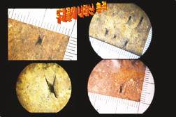 성서초등학생들의 타살 추정에 중요한 근거로 제시된, 소년들의 두개골에 있는 외상. 약 1.4~2.0mm 정도의 크기인 이 외상들은 사각형의 예리한 모서리를 가진 물체에 의해 찍힌 흔적이 역력하다. <경북대 법의학팀> 제공.