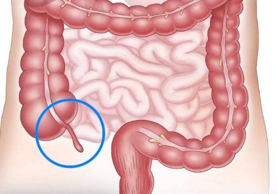 맹장에 꼬리처럼 달려있는 충수(파란색 원). 유익한 박테리아 저장소인 것으로 밝혀졌습니다.[사진=유튜브 화면캡처]