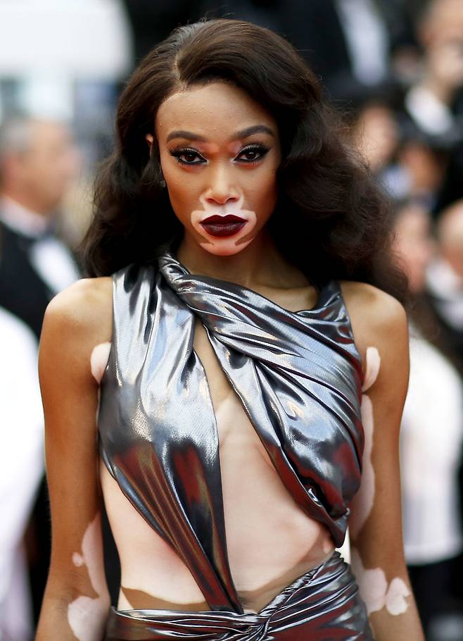 스타워즈 시사회에 참석한 위니 할로우가 15일(현지시간) 자신의 백색증 부위를 노출하고 레드카펫을 걷고 있다. [로이터=연합뉴스]