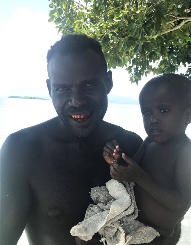 솔로몬인 중에는 비틀넛을 씹어 치아가 붉은 사람들이 많다.