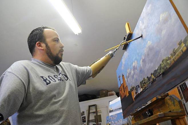 두 팔을 잃었지만 삶에 대한 희망을 버리지 않은 데이먼. 예술가로서 인생의 제 2막이 펼쳐졌다.