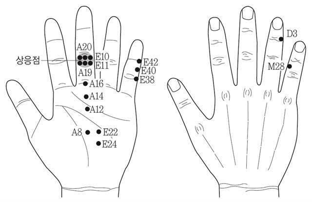 쇄골 통증 있는 여성