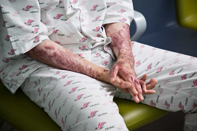 K-9 자주포 폭발사고 피해자 이찬호 예비역 병장 ⓒ시사저널 최준필