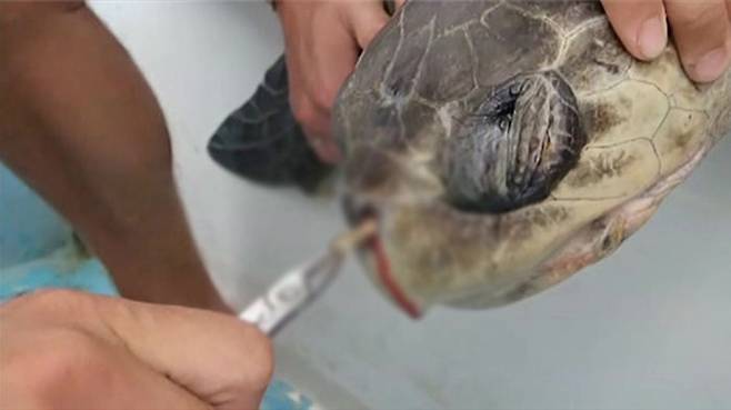 거북이 코에서 빨대를 제거하는 모습 (사진=유튜브 캡쳐)