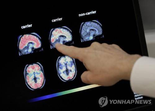 양전자단층촬영(PET)한 뇌 [AP=연합뉴스]