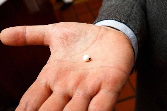 굴 음식에서 발견된 진주. [사진 뉴욕포스트]