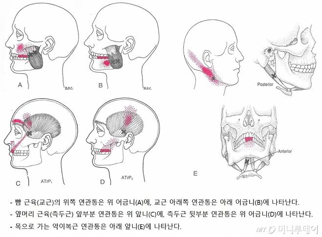 자료제공=연세대 치과대학병원 구강내과
