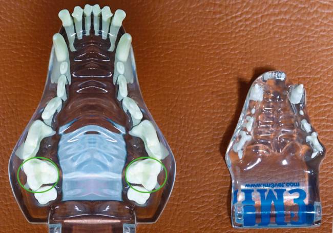 개에게 발견되는 큰 어금니(동그라미)가 고양이에게는 거의 발달하지 않는다. 개의 치아 모형(왼쪽)과 고양이의 치아 모형. [사진 제공 · 이영수]