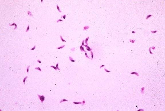 톡소플라스마 곤디의 원충. [중앙포토]