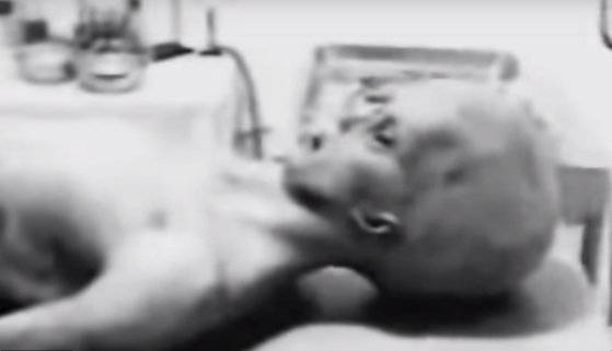 1995년 공개된 로즈웰 외계인 시체 해부 영상. 후에 조작이라고 밝혀졌다. [사진 유튜브 mysterydatabase 계정 캡처]