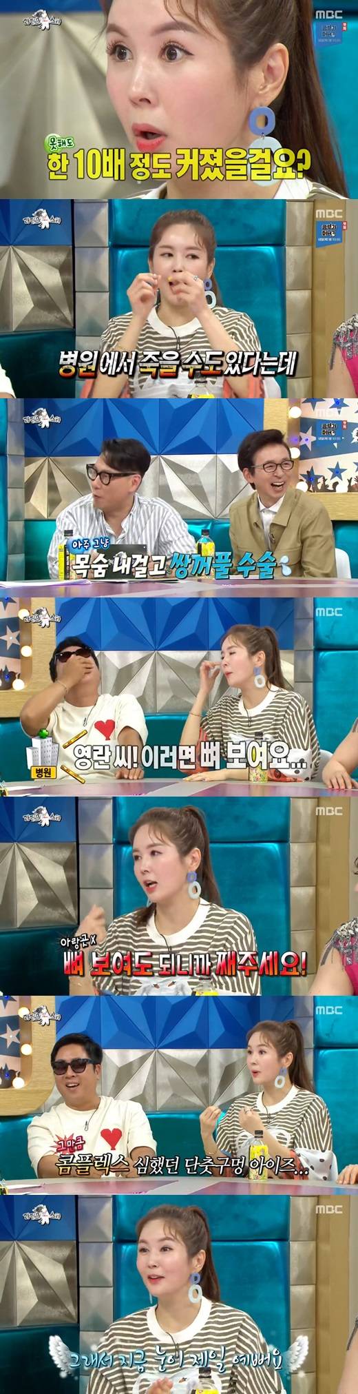장영란 쌍커풀수술. /사진=라디오스타 방송캡처