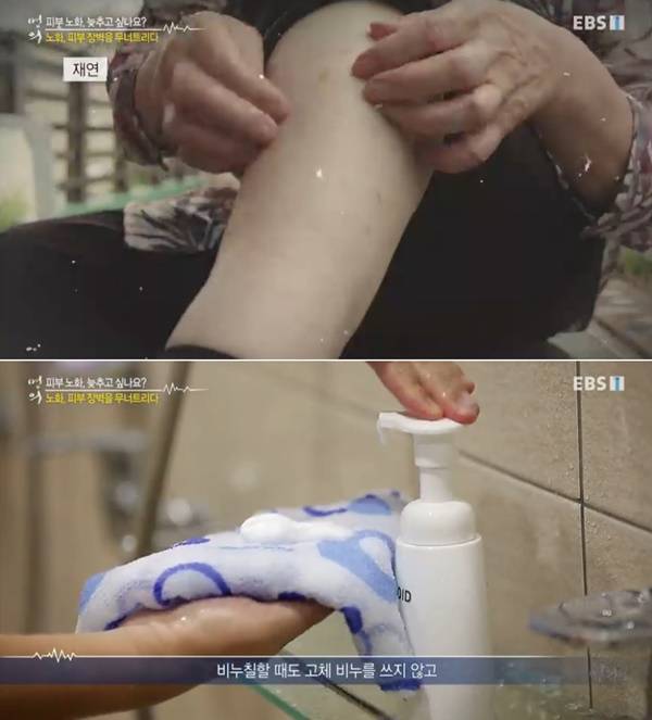 사진=KBS 1TV '명의' 방송화면 캡처