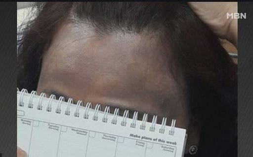 천연 염색약 헤나 부작용 사례. MBN