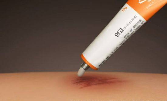 튜브형 연고의 유통기한은 개봉 후 6개월입니다. 사용후에는 튜브의 끝부분을 반드시 깨끗하게 닦아 보관하는 것이 좋습니다. [사진=유튜브 화면캡처]