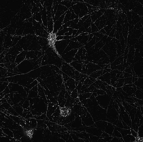 화합물을 투여해 건강해진 미토콘드리아(현미경 이미지) [스크립스 연구소 로널드 데이비스 랩 제공]