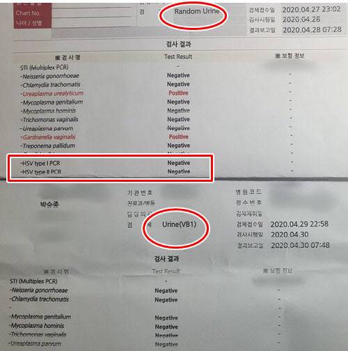 약쿠르트가 공개한 자신의 성병 소변 검사 결과지 (사진=약쿠르트 유튜브)