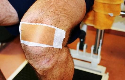 맥코넬 테이핑 방법